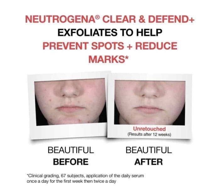 Neutrogena Clear and Defend+ Serum 30ml - Image 3