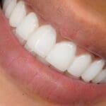 Oral Care